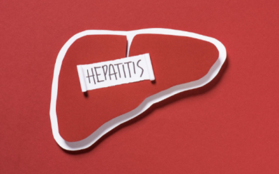 Hepatitis B: Symptoms and Treatments
